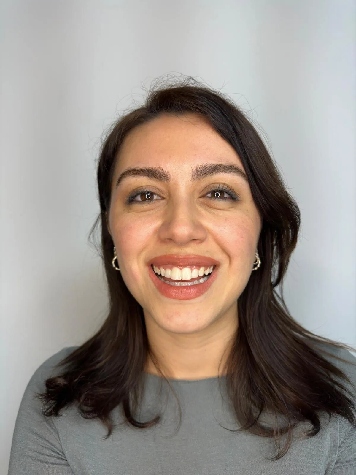 Real patient result — Dr. Türker Yücesoy