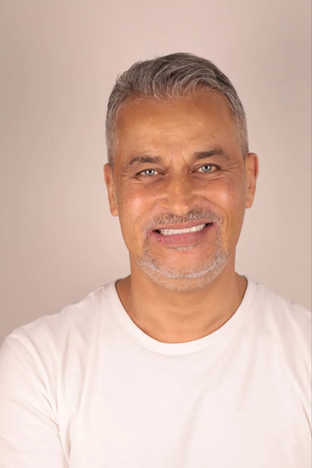Real patient result — Dr. Türker Yücesoy
