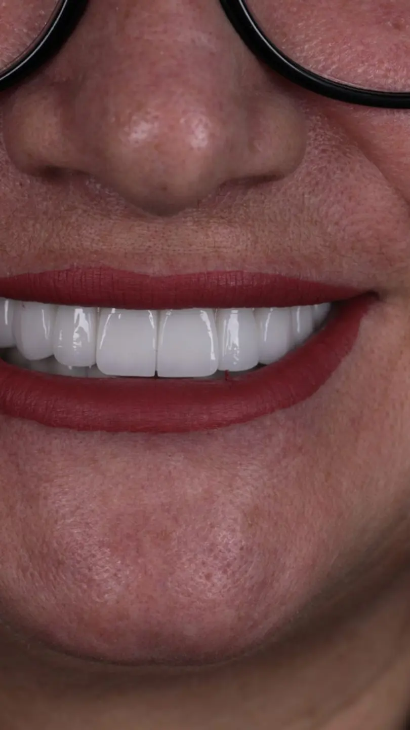 Our patient’s smile 3