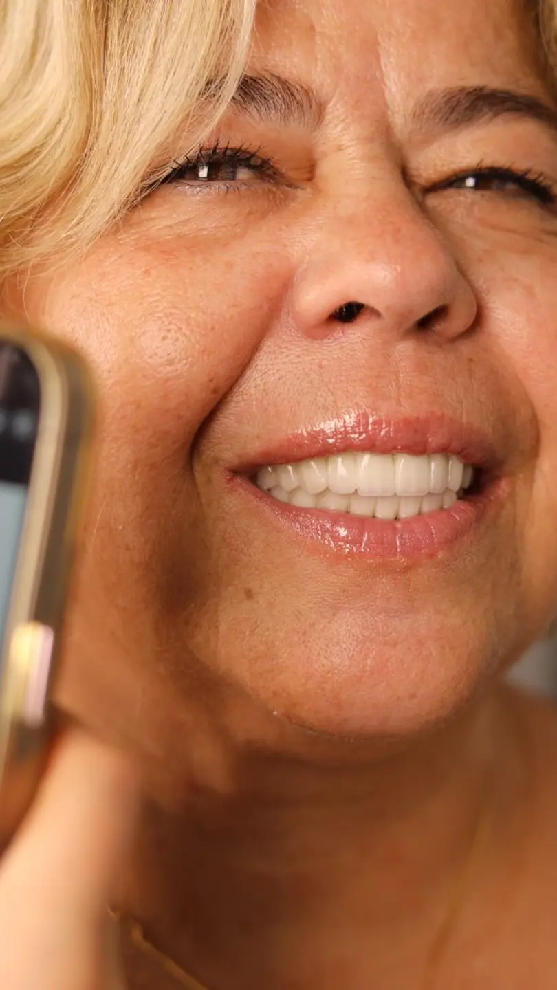 Our patient’s smile 4