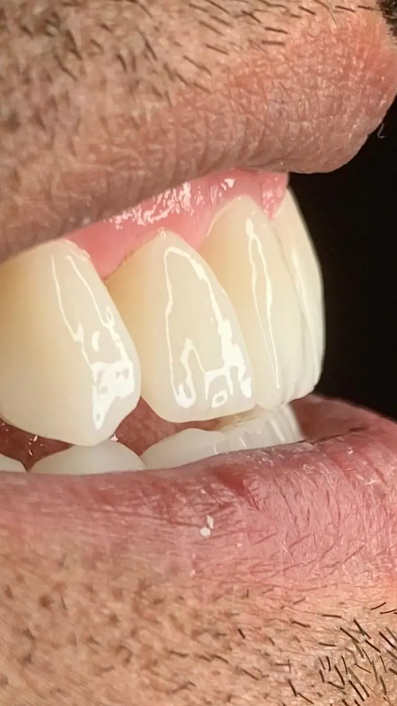 Our patient’s smile 7