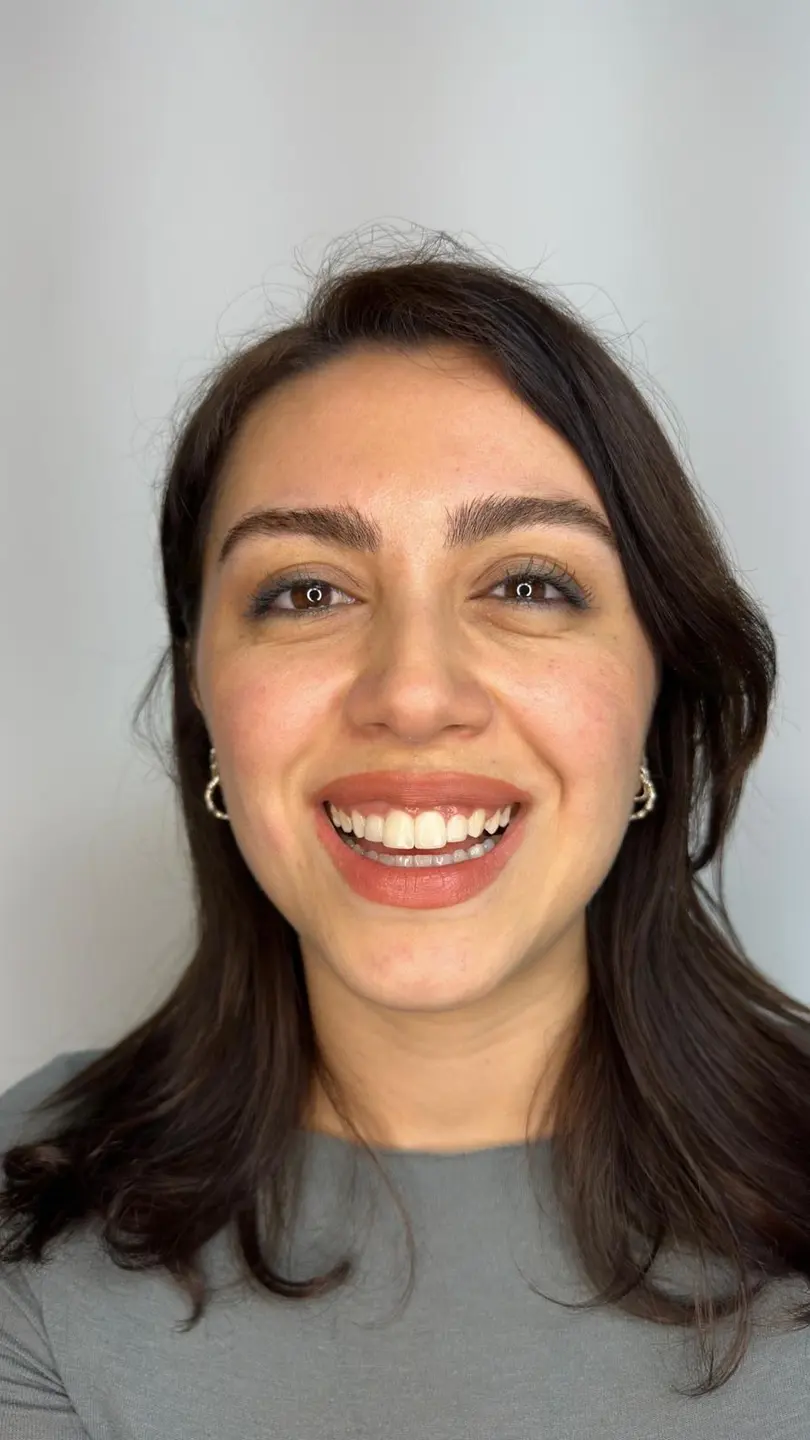 Our patient’s smile 8