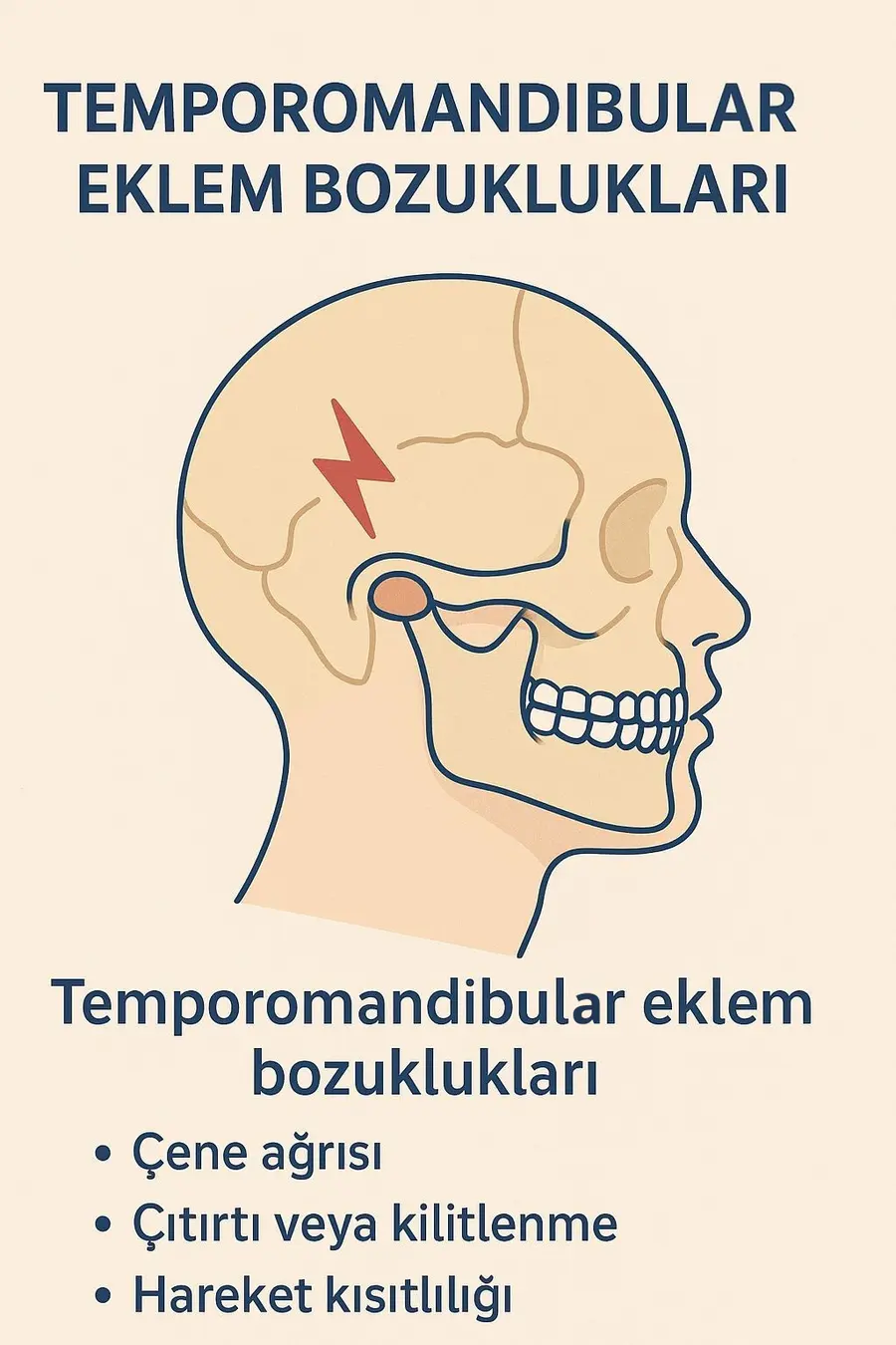 Illustration des troubles de l’articulation temporo-mandibulaire